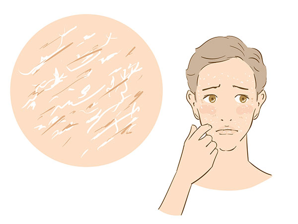 男性の乾燥肌の原因とは？改善する方法や対策についてご紹介